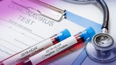 Colombia importará 50.000 pruebas para Covid19