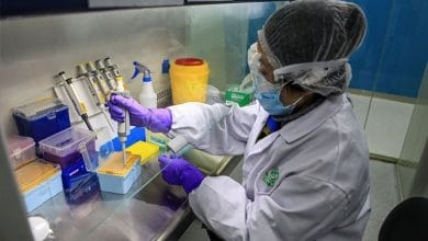 Cómo funciona la prueba de Covid19