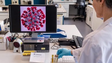 Llegaron reactivos para procesar las pruebas diagnósticas de Covid19