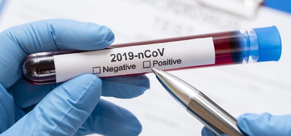 Qué tan común es la infección asintomática de Covid19