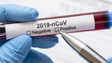 Este es el reporte de casos de Covid19 en Montería