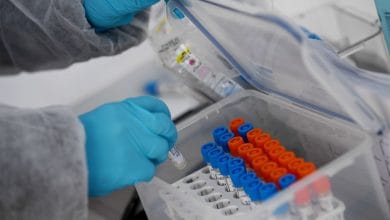 ¿Cuánto duran los anticuerpos contra coronavirus?