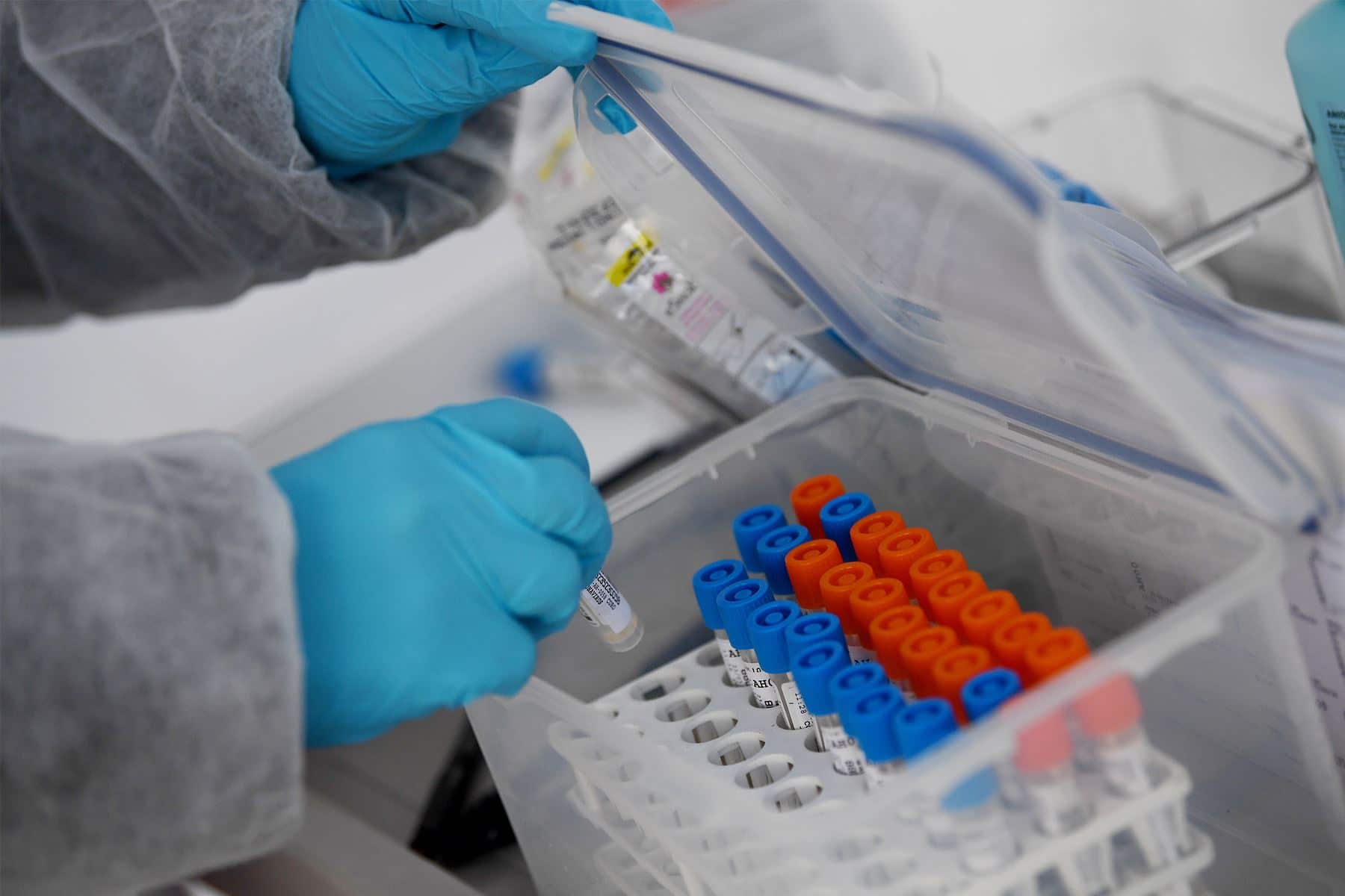 ¿Cuánto duran los anticuerpos contra coronavirus?