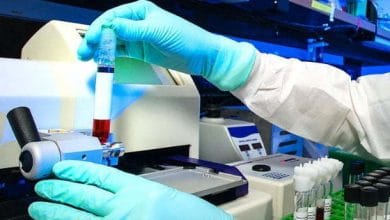 ¿En qué consiste el estudio de seroprevalencia de Covid19?