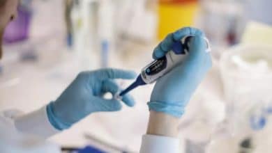 OMS alerta sobre nuevos virus animales que podrían contagiar a humanos