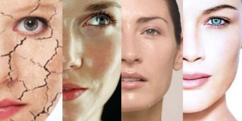 ¿Qué tipo piel es más propensa a las arrugas?