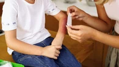 Cómo evitar quemaduras y otros accidentes en casa: MinSalud