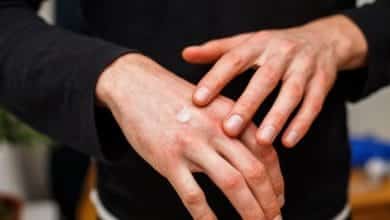 Las 5 alergias más raras y poco frecuentes